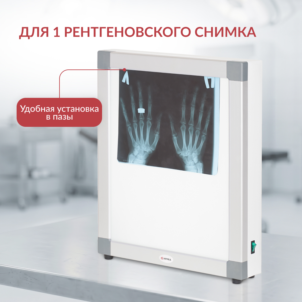 Негатоскоп общего назначения Армед 1-кадровый 
