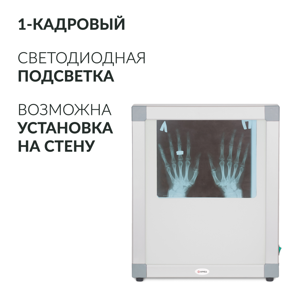 Негатоскоп общего назначения Армед 1-кадровый 