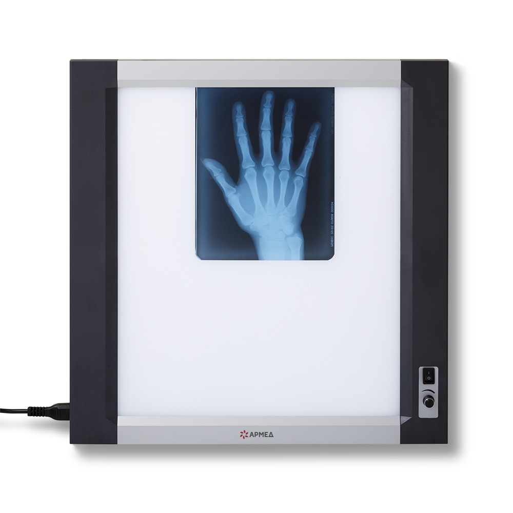 Негатоскоп общего назначения Армед 1-кадровый LUX 