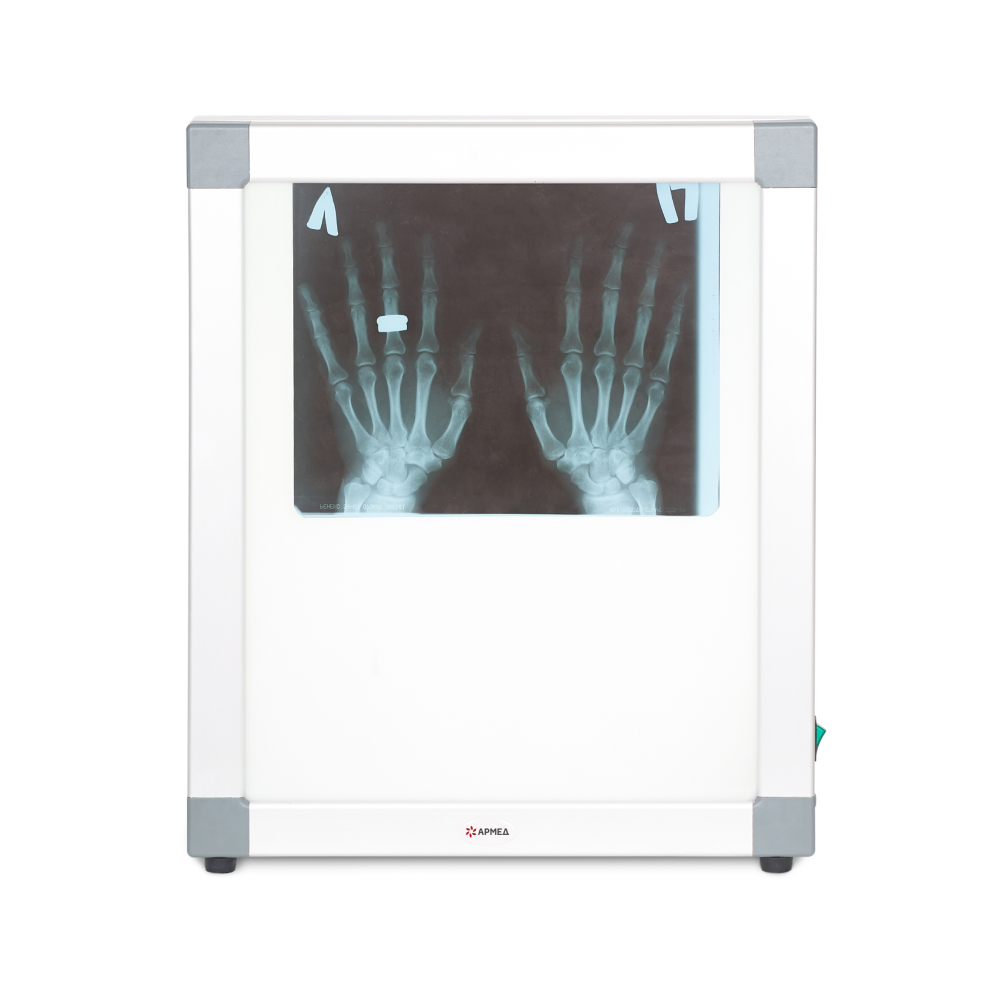 Негатоскоп общего назначения Армед 1-кадровый 